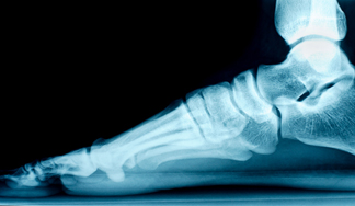 xray foot