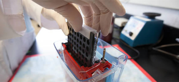 Einstein Awarded $157 Million in NIH Grants for Basic Science and Disease Areas in 2014