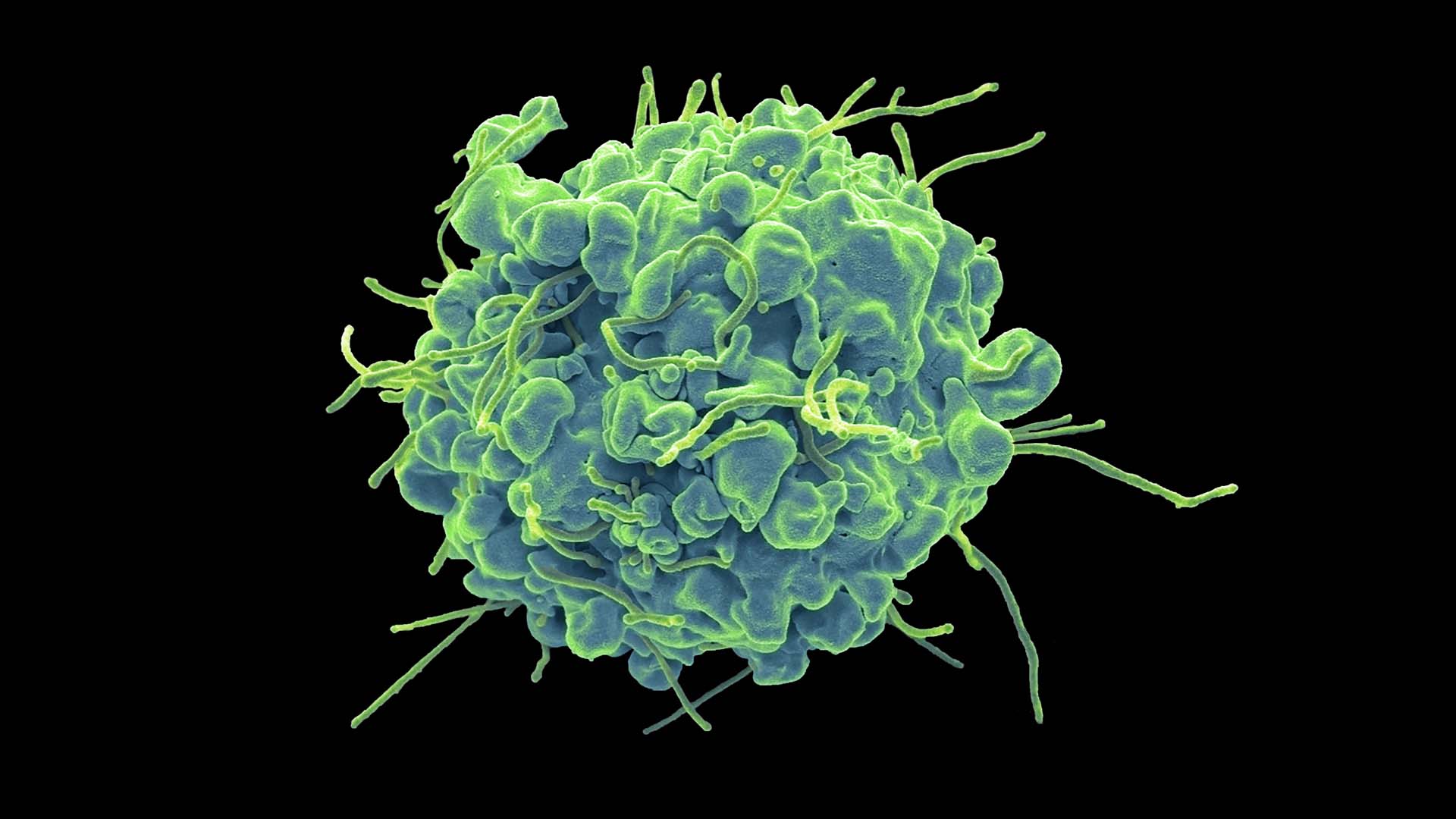 Promising Approach Against Treatment-Resistant Cancer