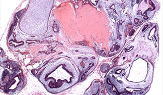 Research Pathology