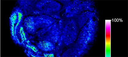 Proteomics Core