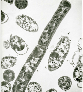 Bacillus anthracis