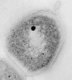 Mycobacterium tuberculosis