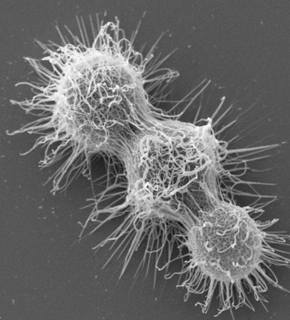 Cryptococcus neoformans