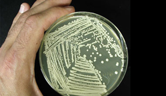 Petri Dish