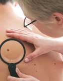 Skin Cancer Screening Dermatology Montefiore Medical Center Albert Einstein College of Medicine Bronx NY