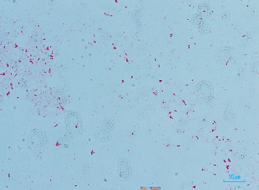 Figure 1 - Gram Stain (1000X)