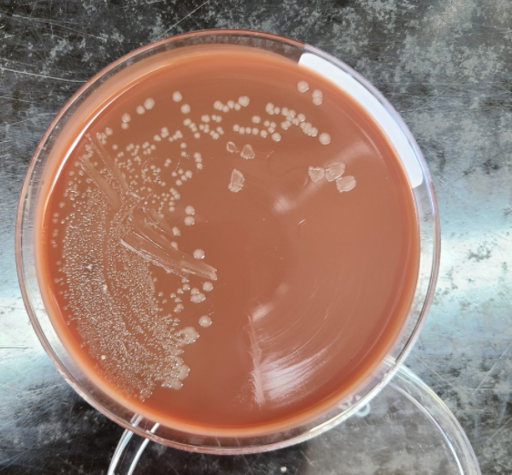 Figure 2 - Growth on chocolate agar