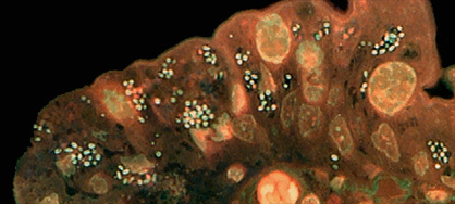 microsporidia in tissue