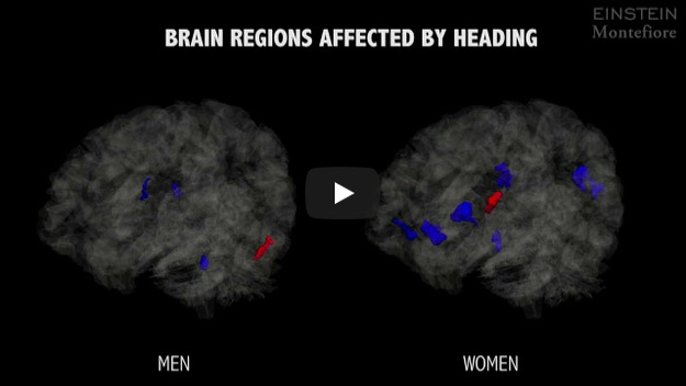 Heading football and head impacts 'change blood patterns in brain', Soccer