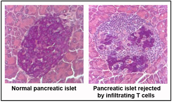 pancreatic islet