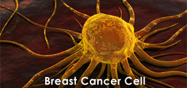 Einstein Scientists Find Crucial Molecule Involved in Spread of Breast Cancer