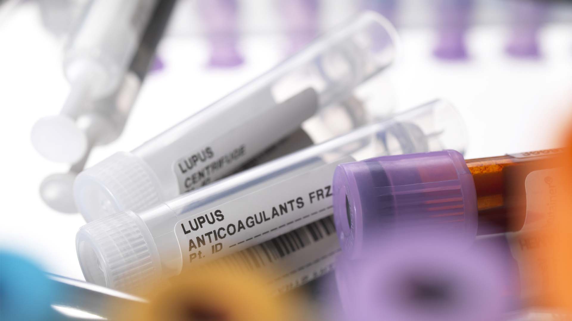 Discovery of Major Cause of Lupus Complication Leads to Clinical Trial of Promising Therapy