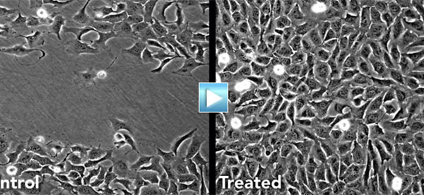Nanoparticle Therapy Promotes Wound Healing