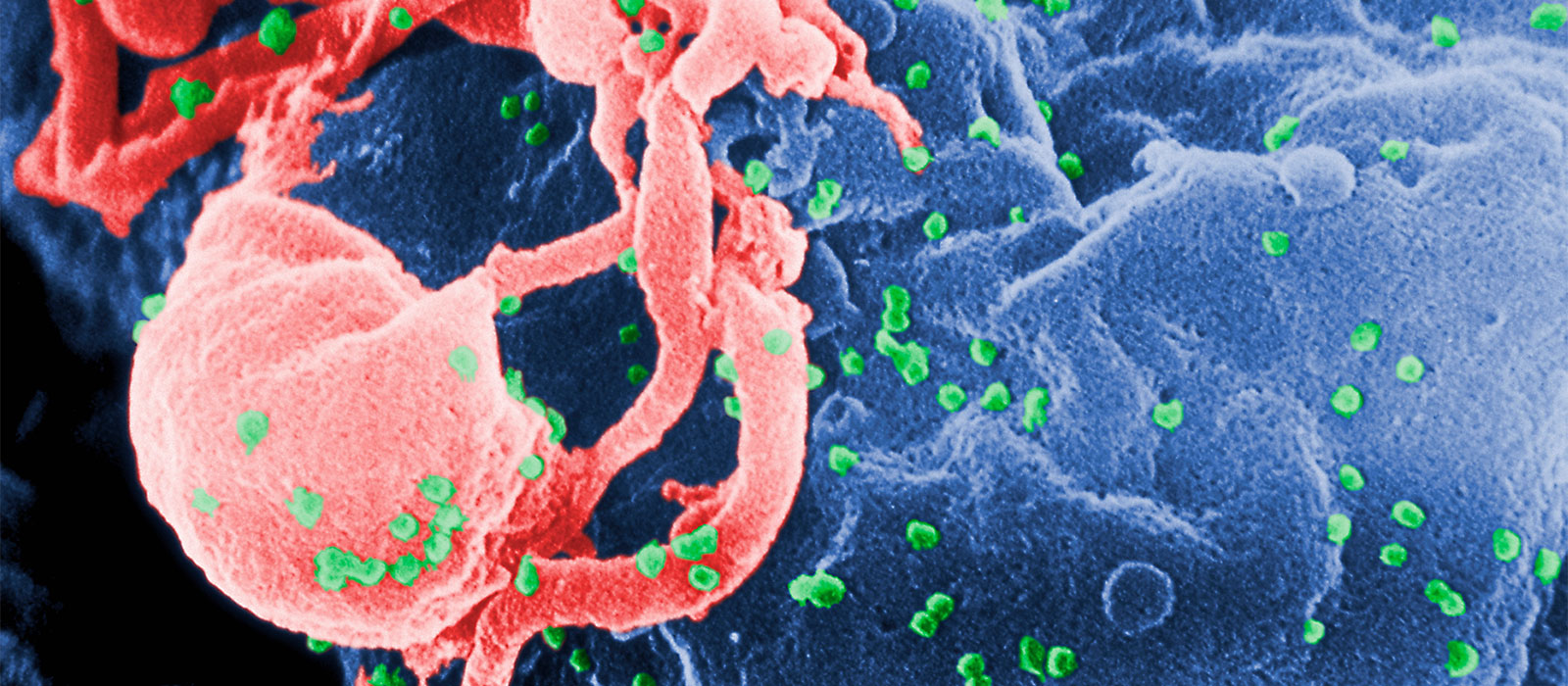 New Drug Target for HIV-1