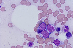 Targeting Blood Cancers