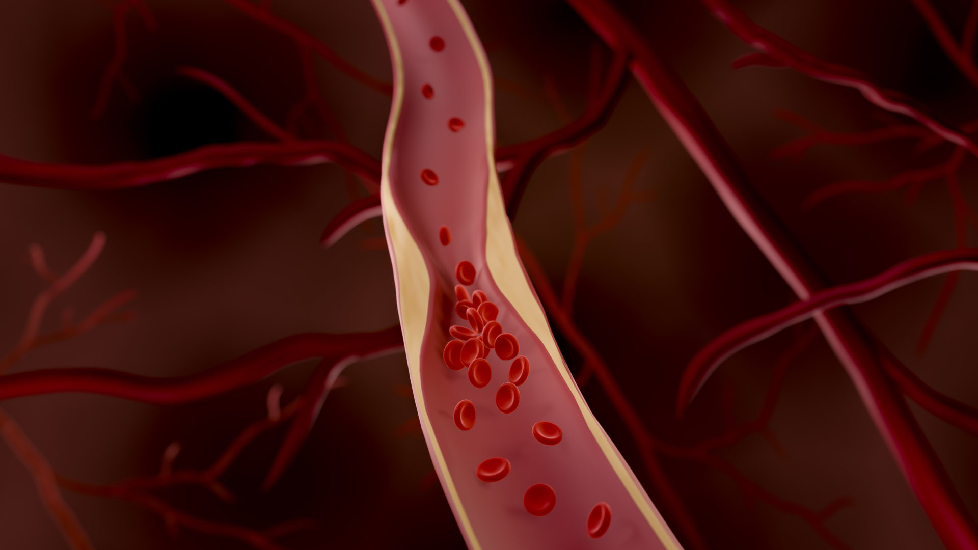 Possible Strategy for Preventing Artery Narrowing