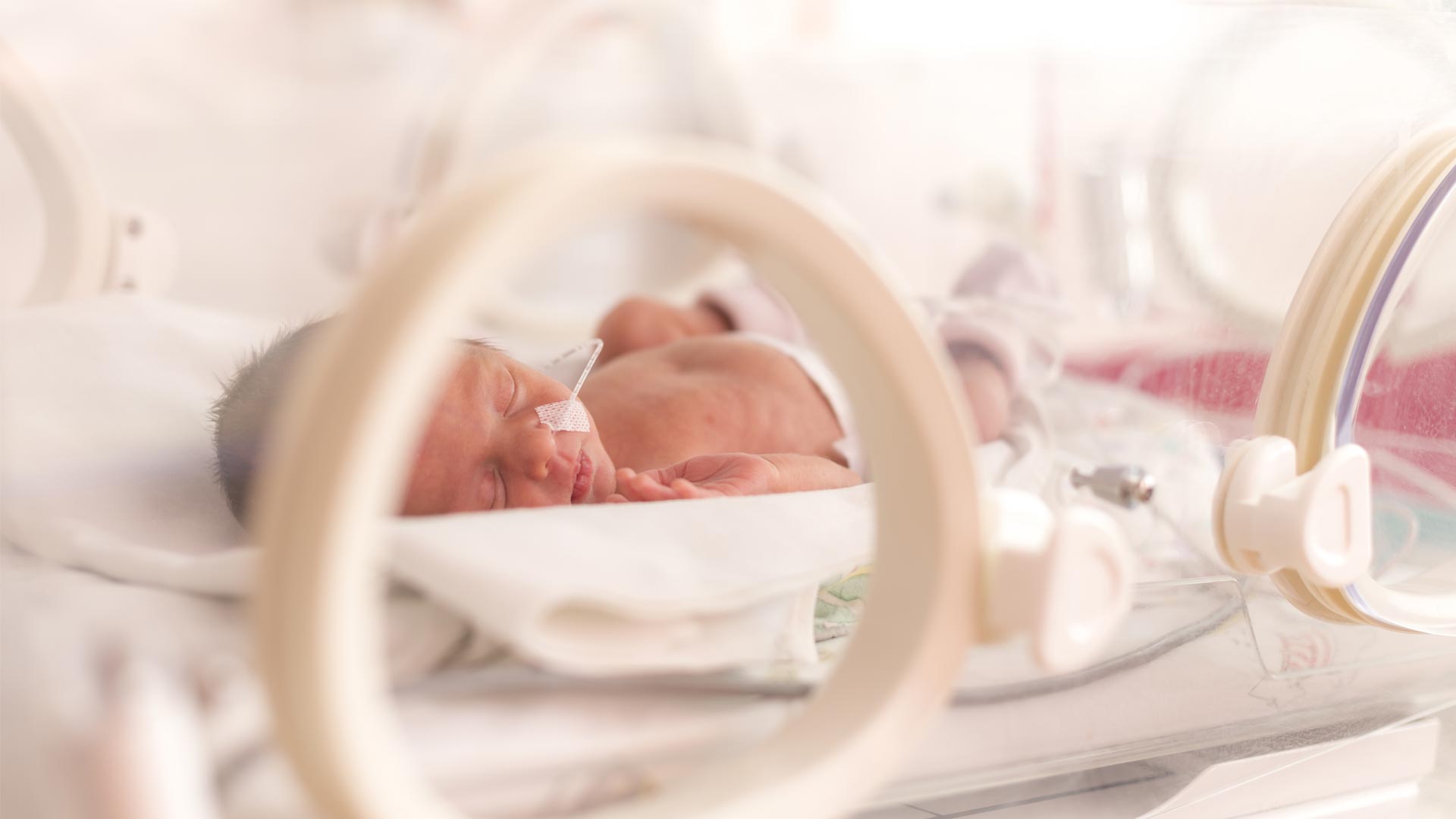Investigating Brain Hemorrhages in Premature Infants