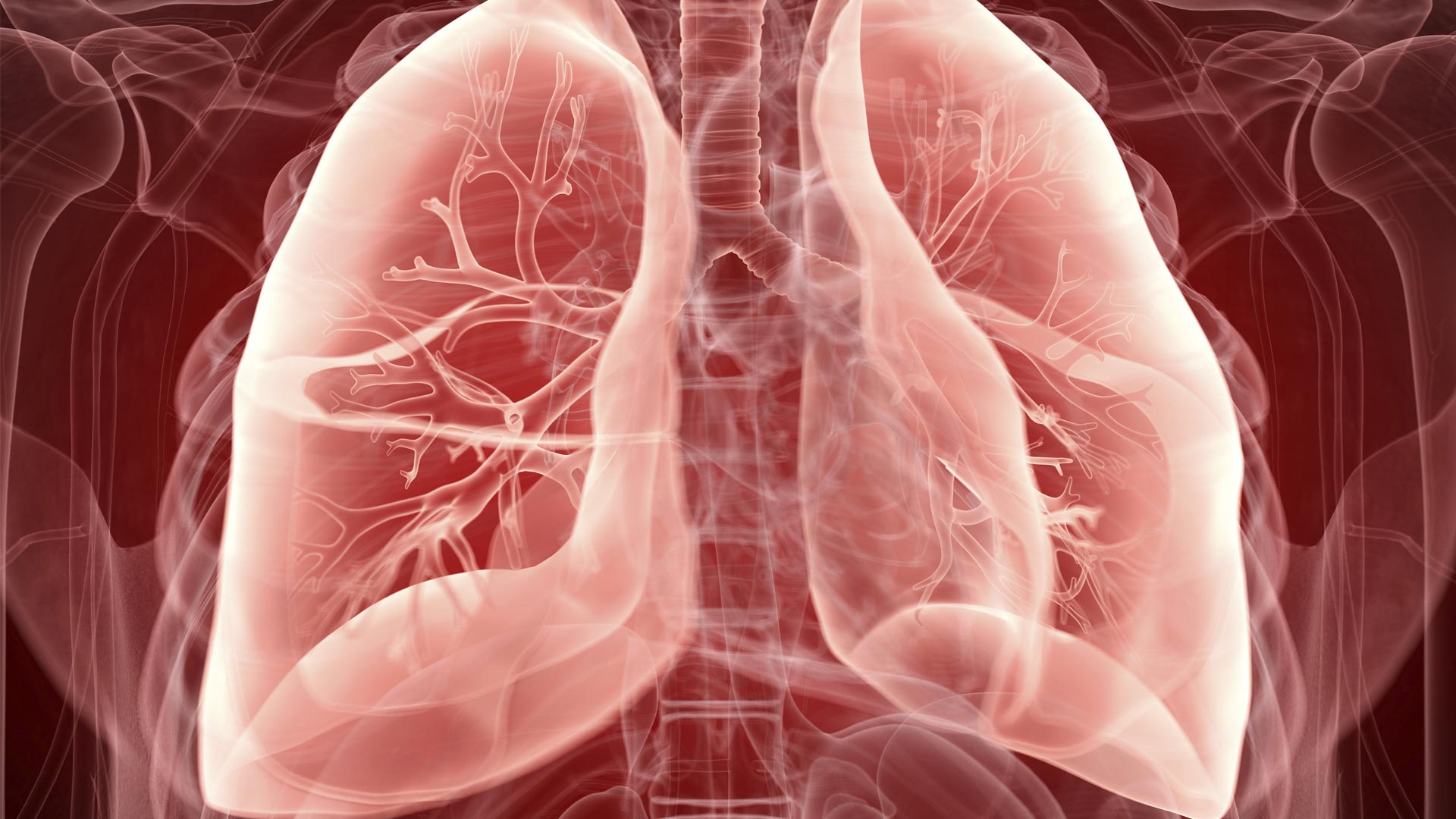 Using Exhaled RNA Molecules to Diagnose Airway Disease