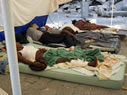 Patients resting in recovery area