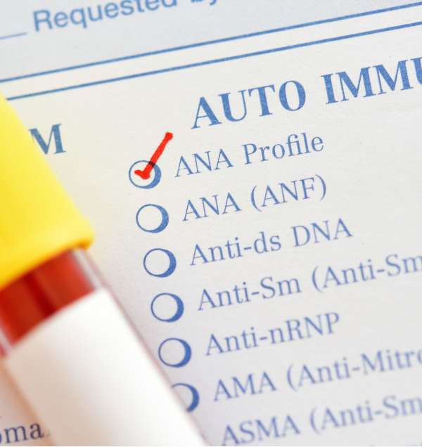 ANA Antibodies